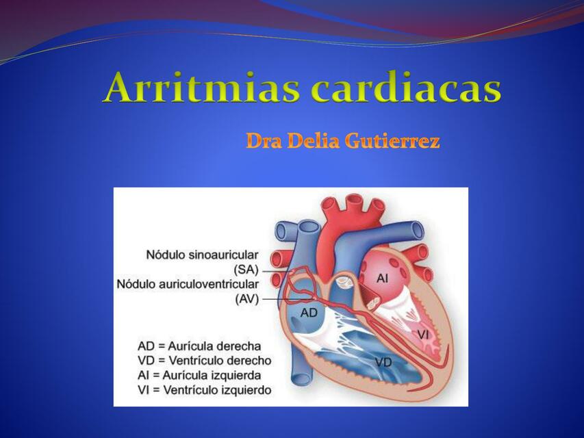 Arritmias cardiacas 