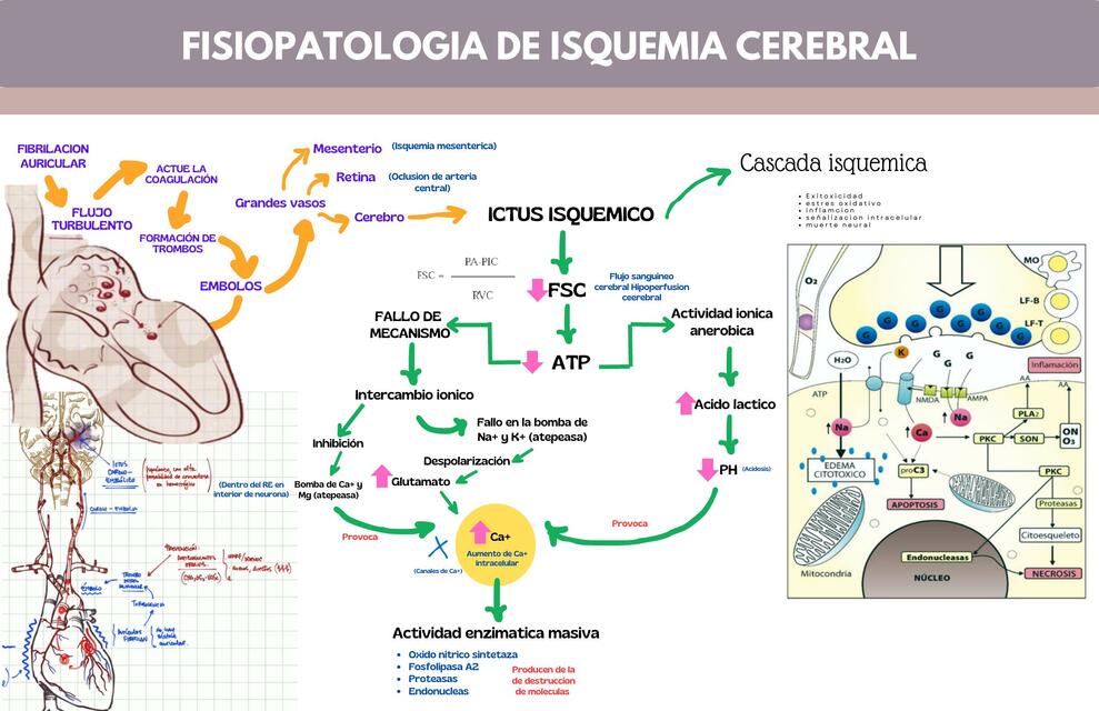 acv isquemico