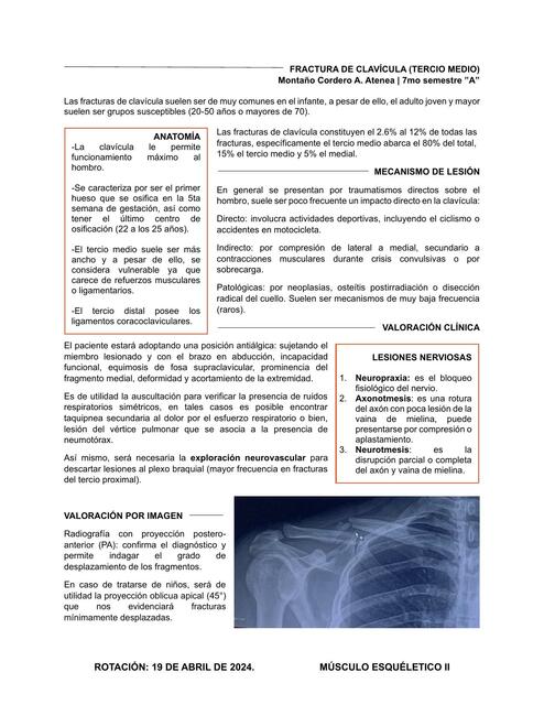 FX Clavícula MÚSCULO II