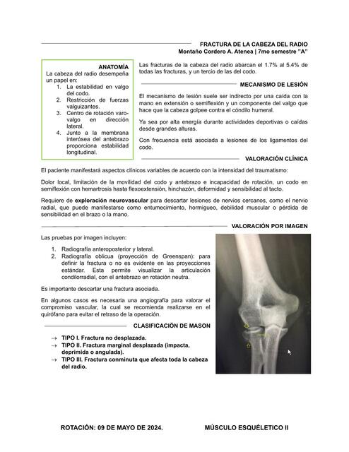 FX cabeza del codo MÚSCULO II