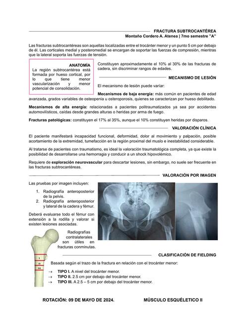 Fx subtrocantérea MÚSCULO II