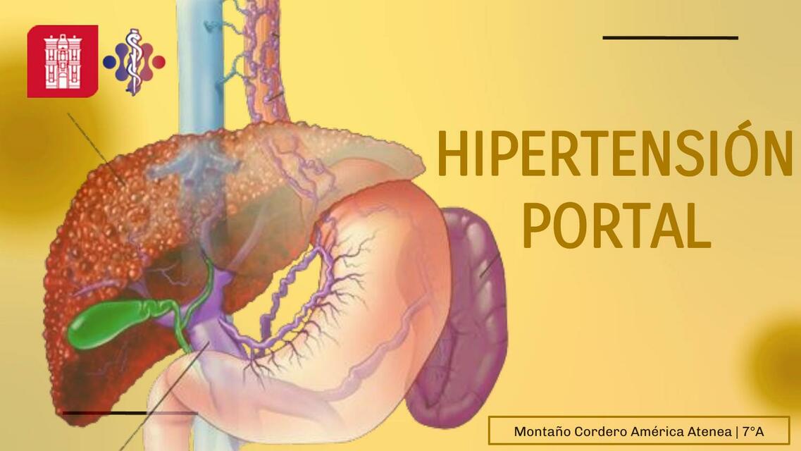 Hipertensión portal y complicaciones