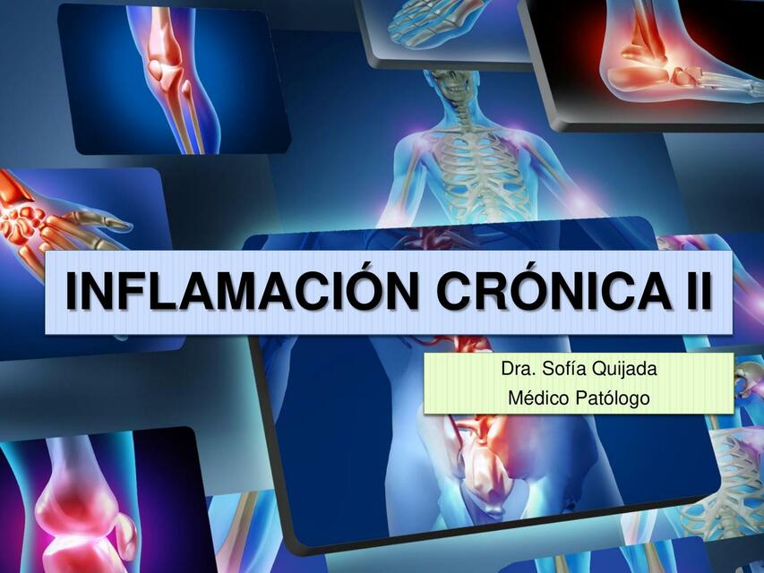 Inflamacion cronica