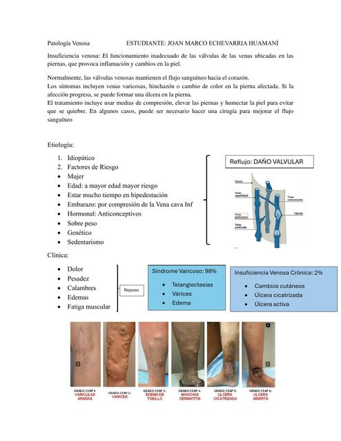 Patología Venosa