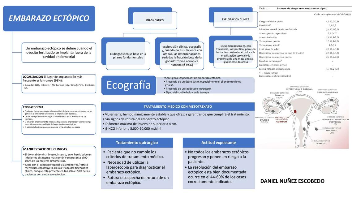 embarazo ectopico bueno