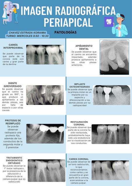 IMAGEN RADIOGRÁFICA PERIAPICAL