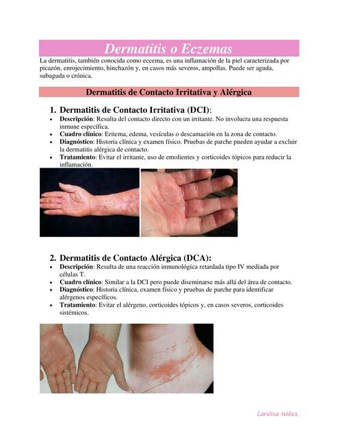 Dermatitis o Eczemas