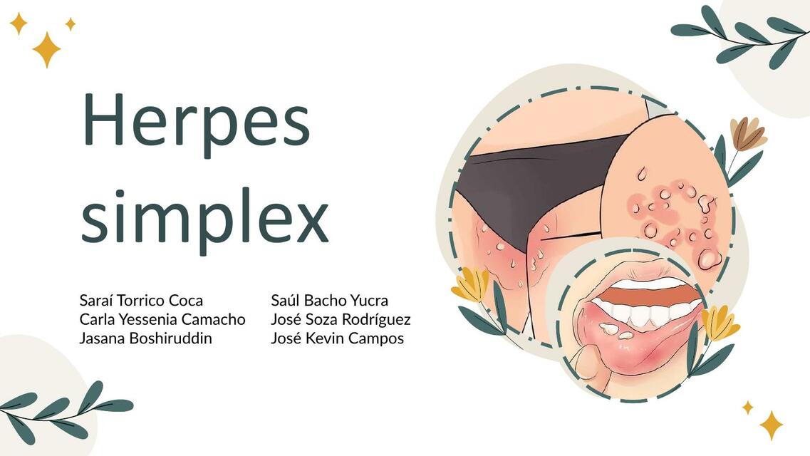 Herpes simplex