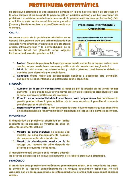 PROTEINURIA ORTOSTÁTICA