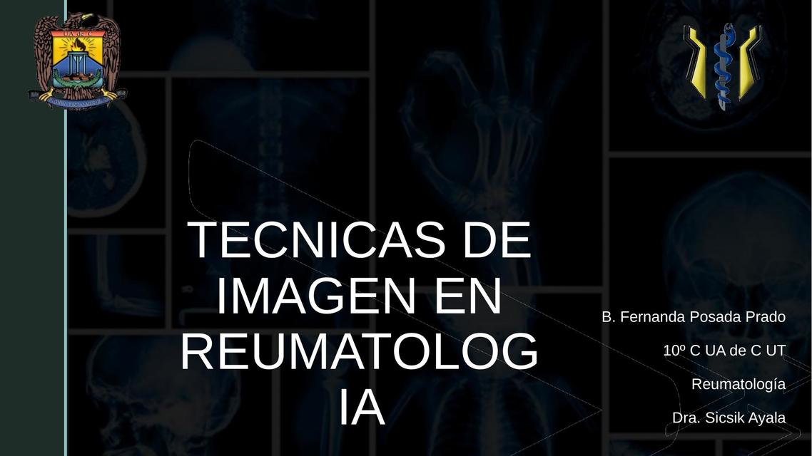 TECNICAS DE IMAGEN EN REUMATOLOGIA