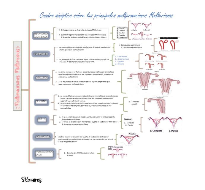 CUADRO SIPNOTICO MALFORMACIONES MULLERIANAS