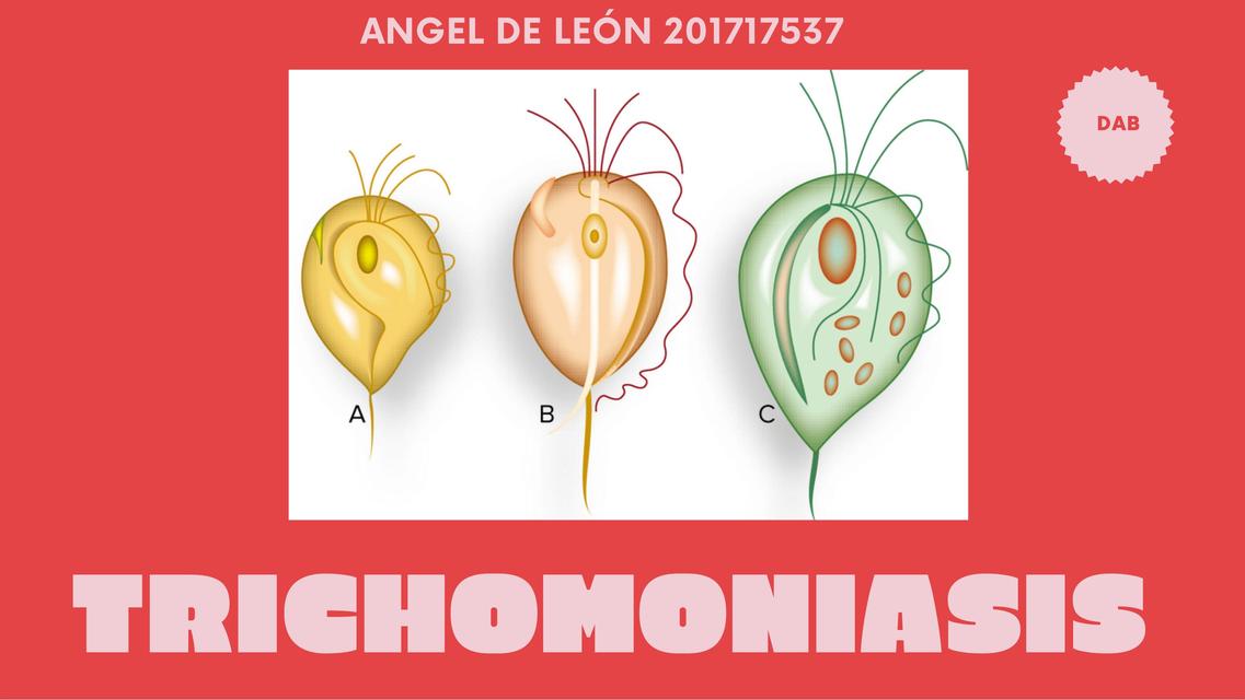 Trichomoniasis 