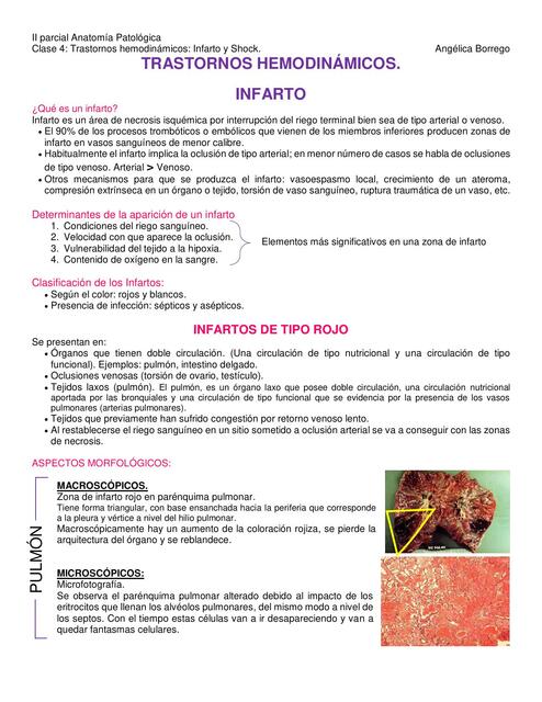 Clase 4 Trastornos hemodinámicos INFARTO y Shock A