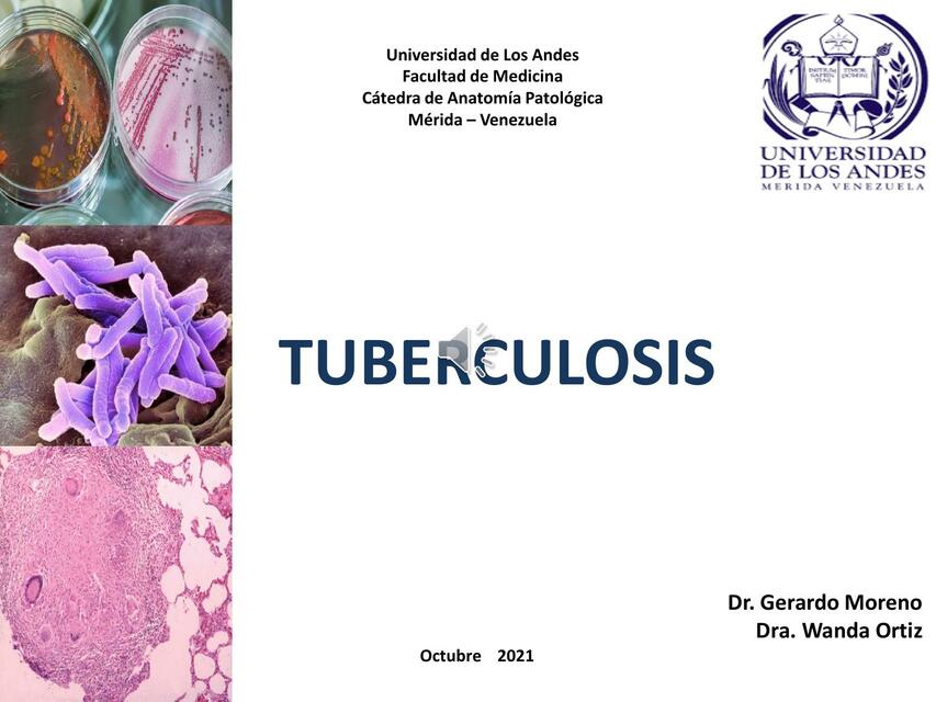 Clase 5 Tuberculosis