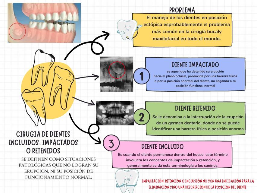 Cirugia de dientes IRi