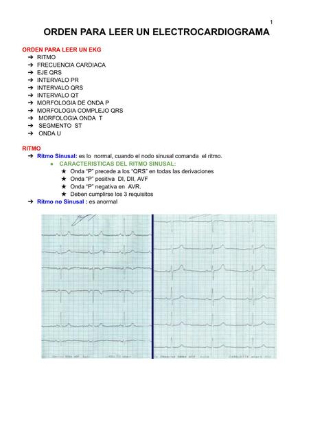 ORDEN PARA LEER UN ELECTROCARDIOGRAMA