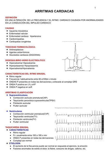 ARRITMIAS CARDIACAS