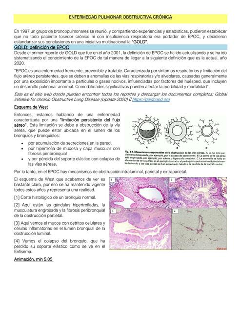 ENFERMEDAD PULMONAR OBSTRUCTIVA CRÓNICA