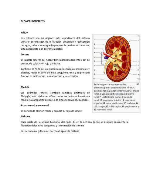 GLOMERULONEFRITIS