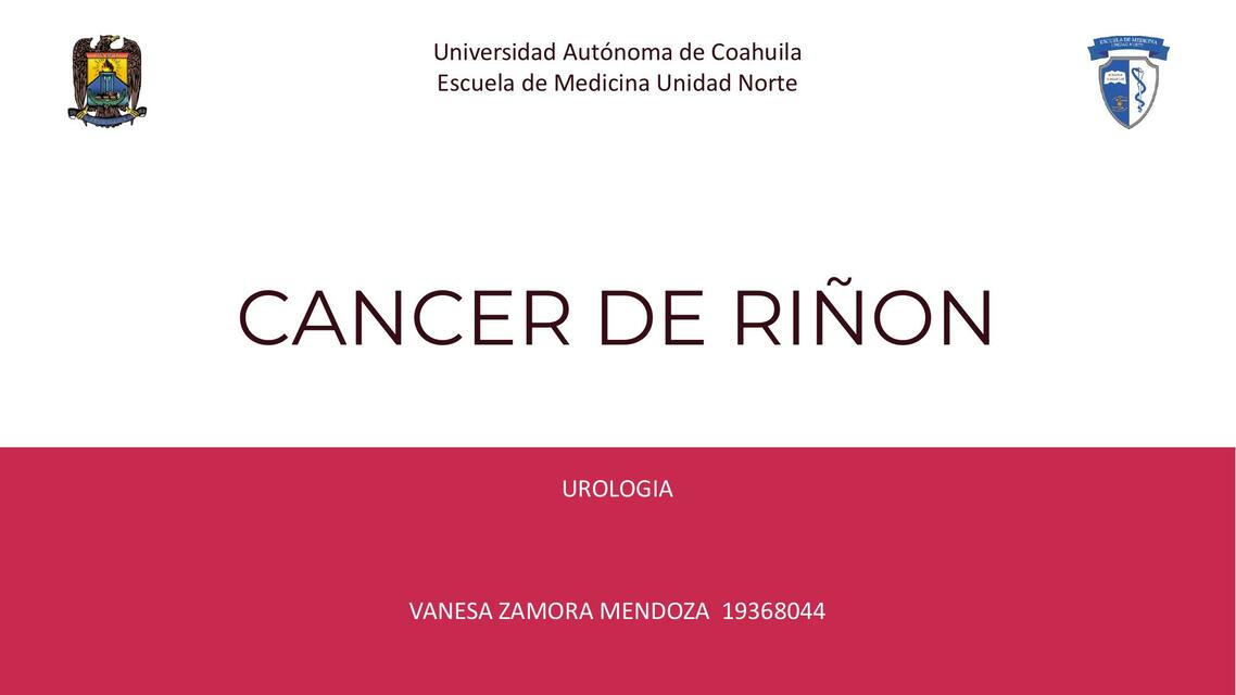 CANCER DE RINON