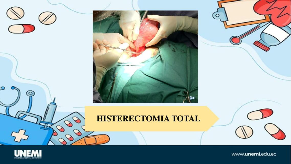 HISTERECTOMIA TOTAL