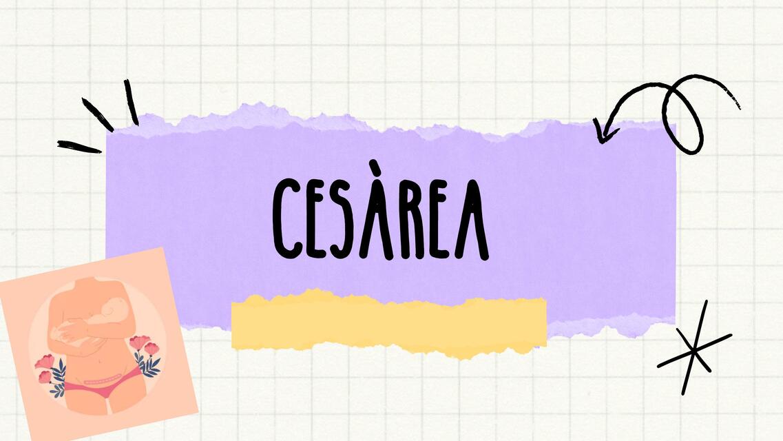 CESAREA