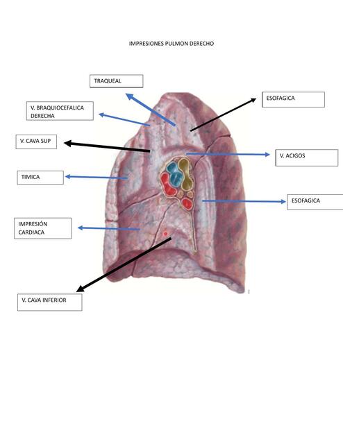 IMPRESIONES PULMON DERECHO