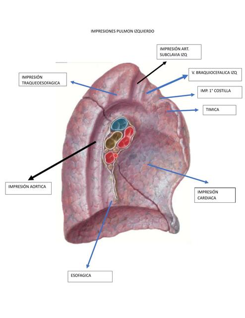 IMPRESIONES PULMON IZQUIERDO