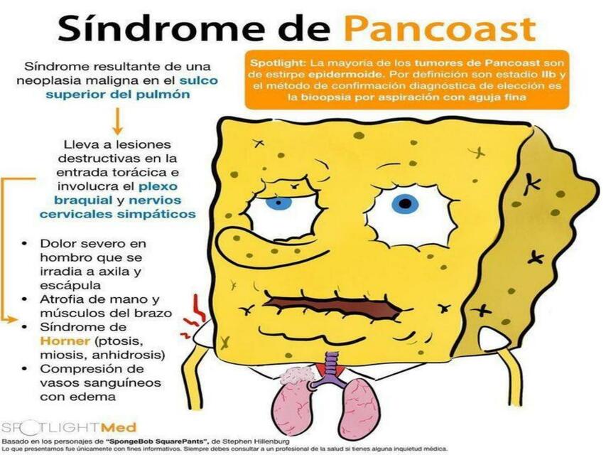 Síndrome de pancoast | Andrea | uDocz