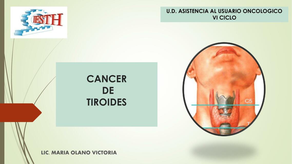 Cáncer de tiroides 