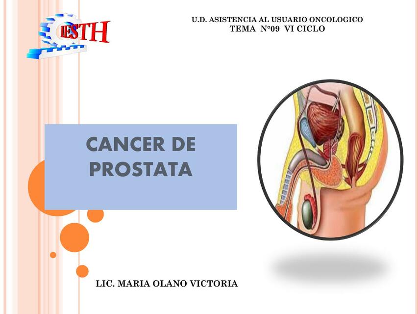 CANCER DE PROSTATA