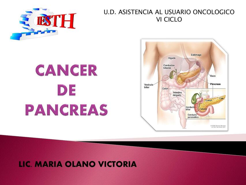 CANCER DE PANCREAS