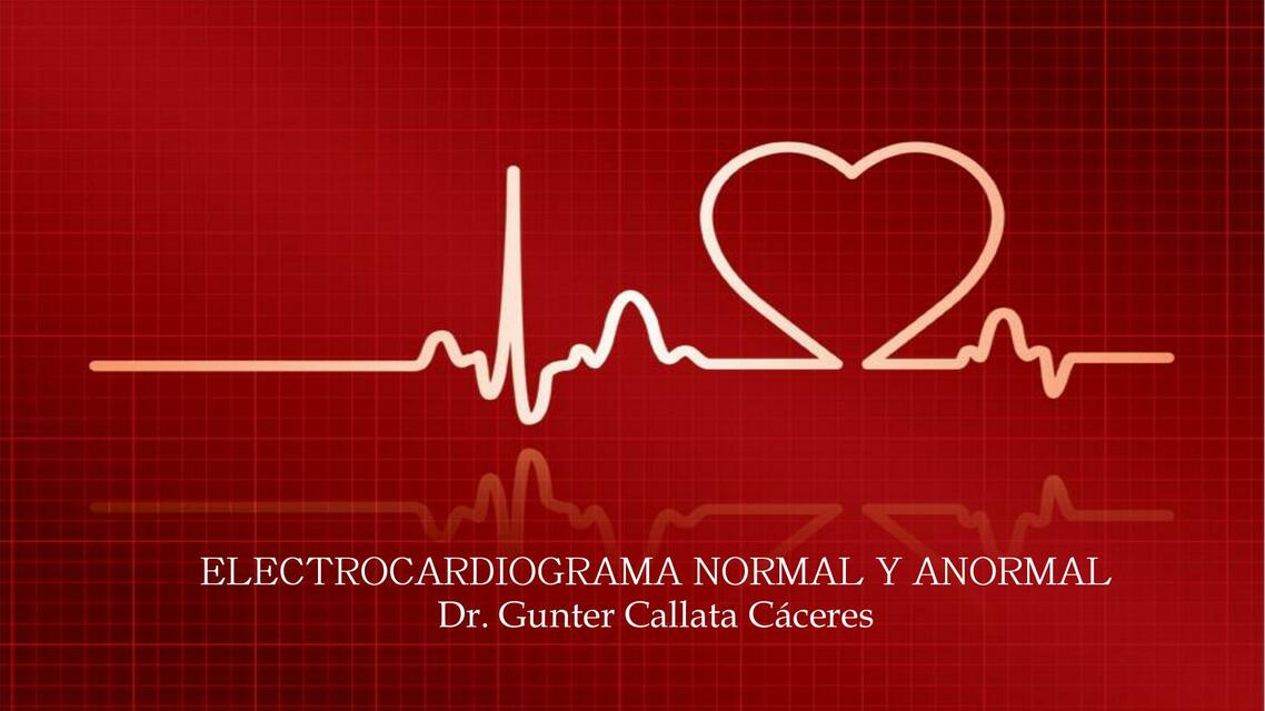 ELECTROCARDIOGRAMA NORMAL Y ANORMAL