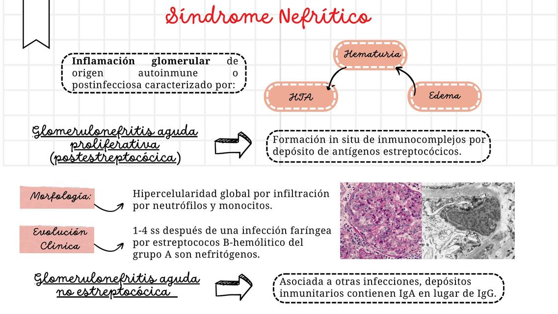 Enfermedades glomerulares