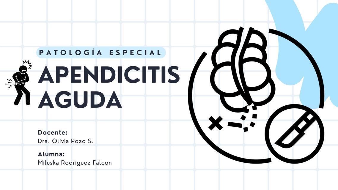 APENDICITIS AGUDA