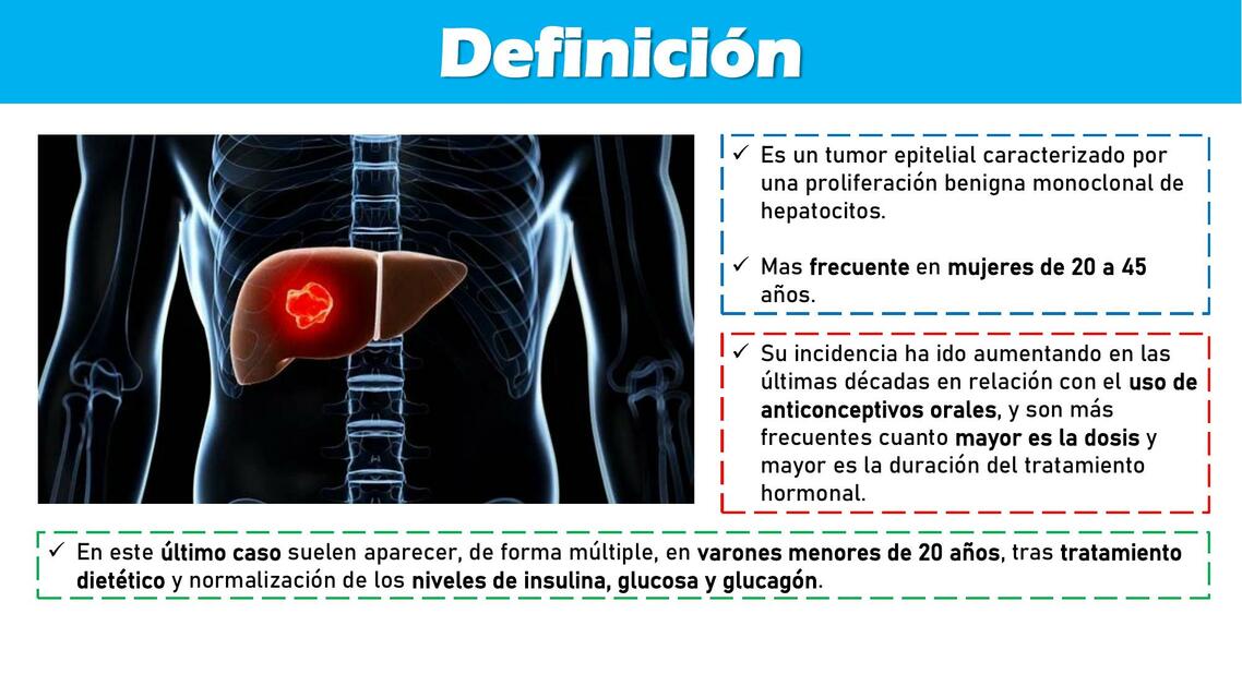 Adenoma Hepático