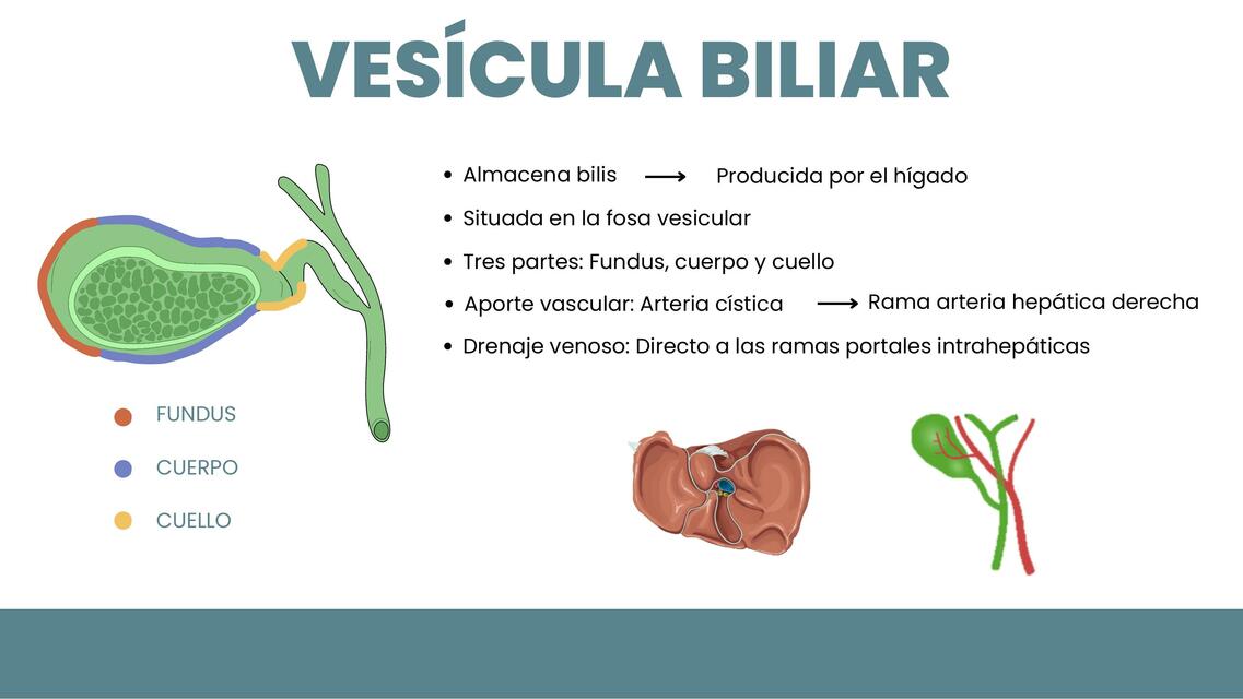 COLECISTITIS AGUDA CALCULOSA