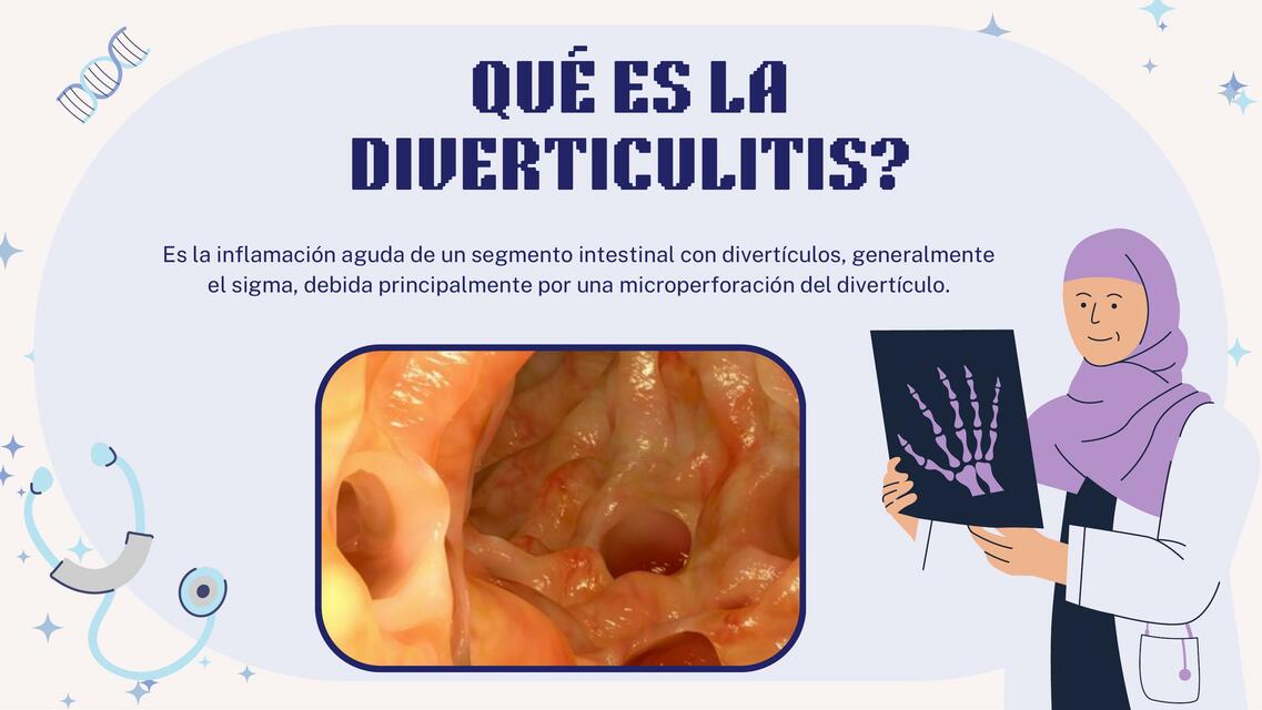 Diverticulitis 