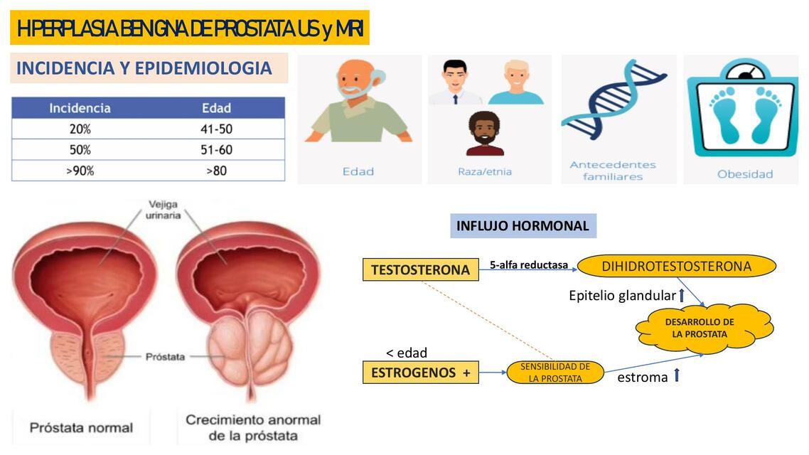 Hiperplasia benigna de próstata 