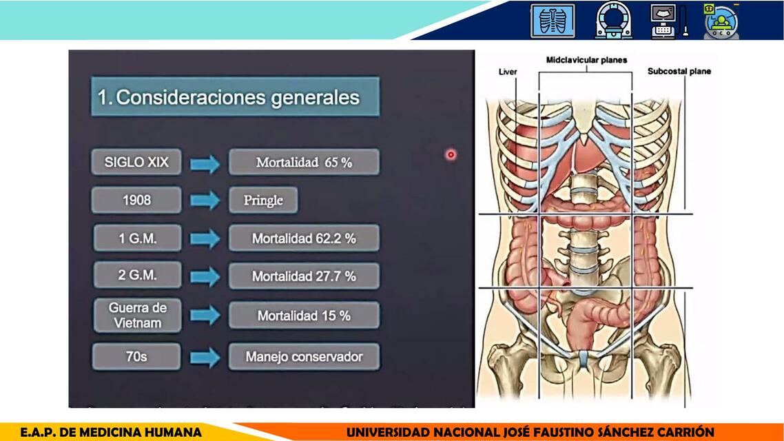 Trauma hepático 