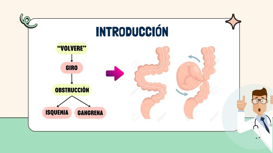 Vólvulo del intestino delgado 