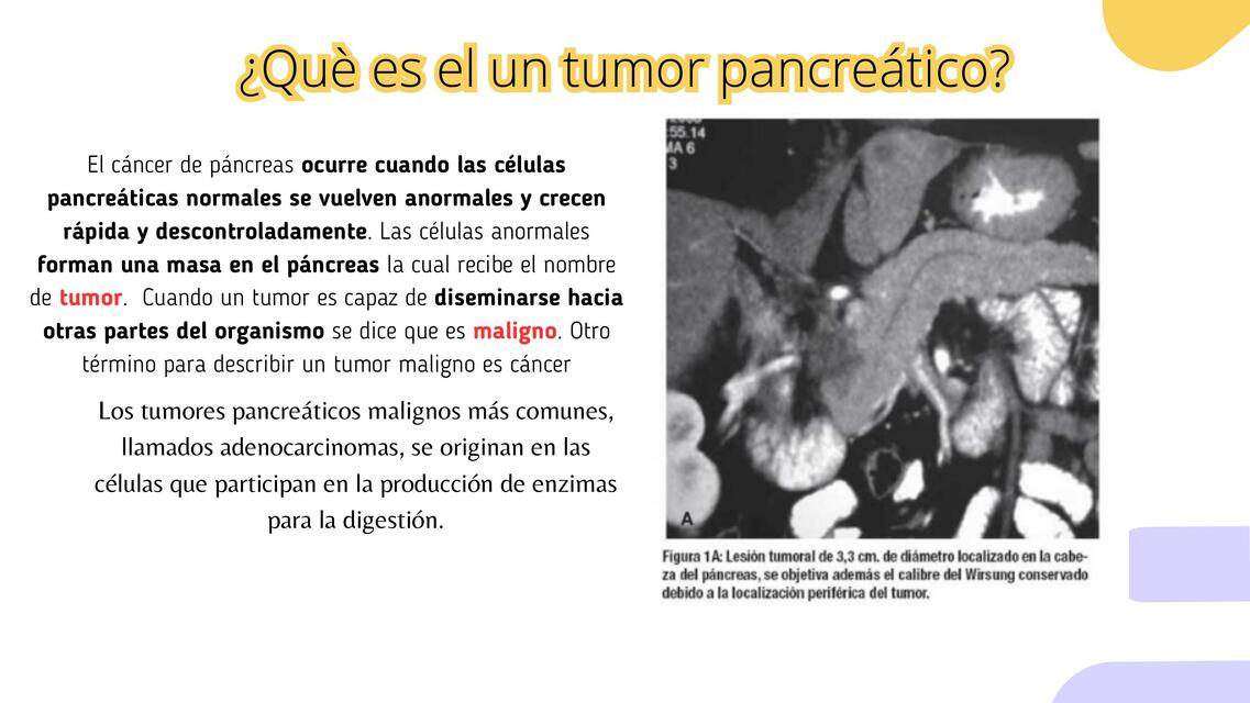 Tumores pancreáticos 