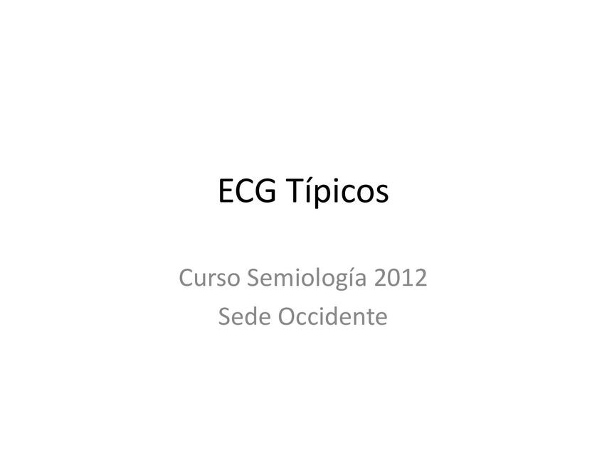 ECG Estudio Individual