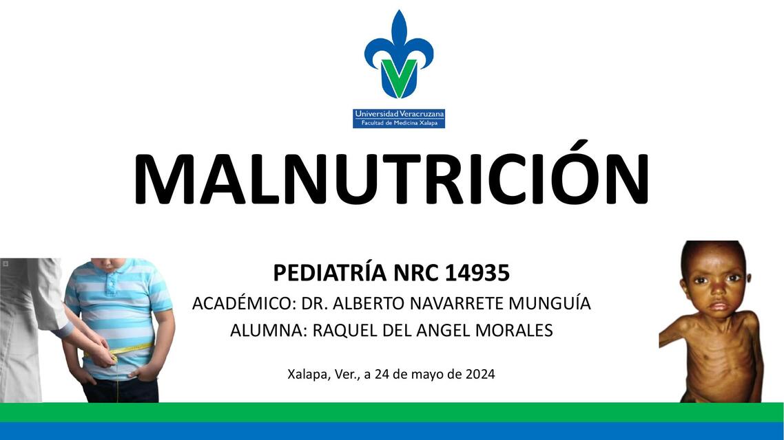 Malnutrición