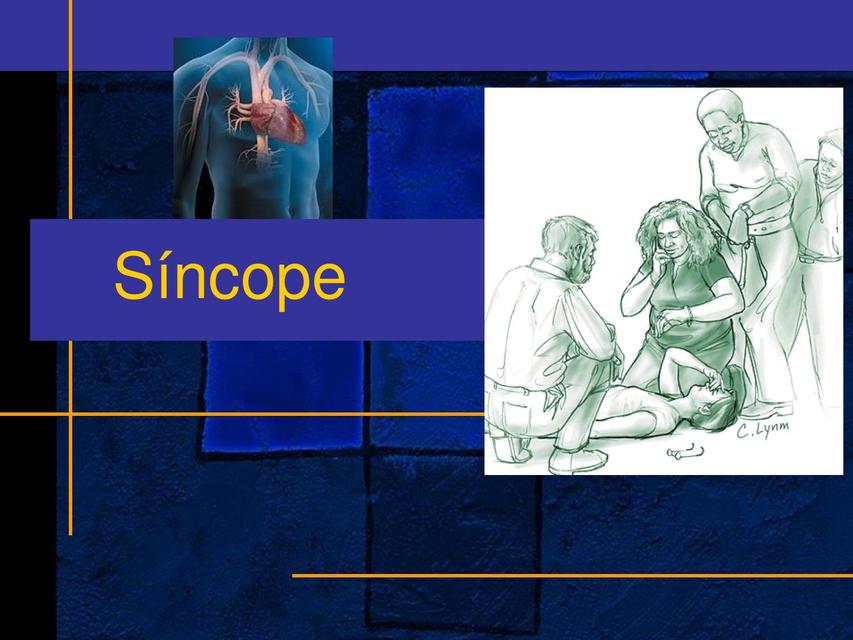 Síncope