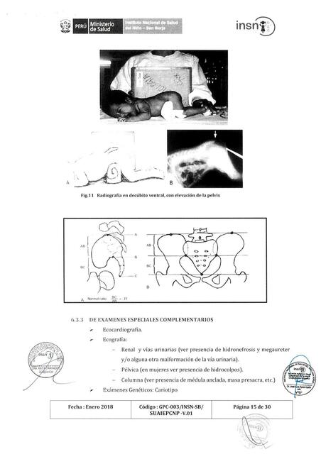 Malformaciones anorrectales