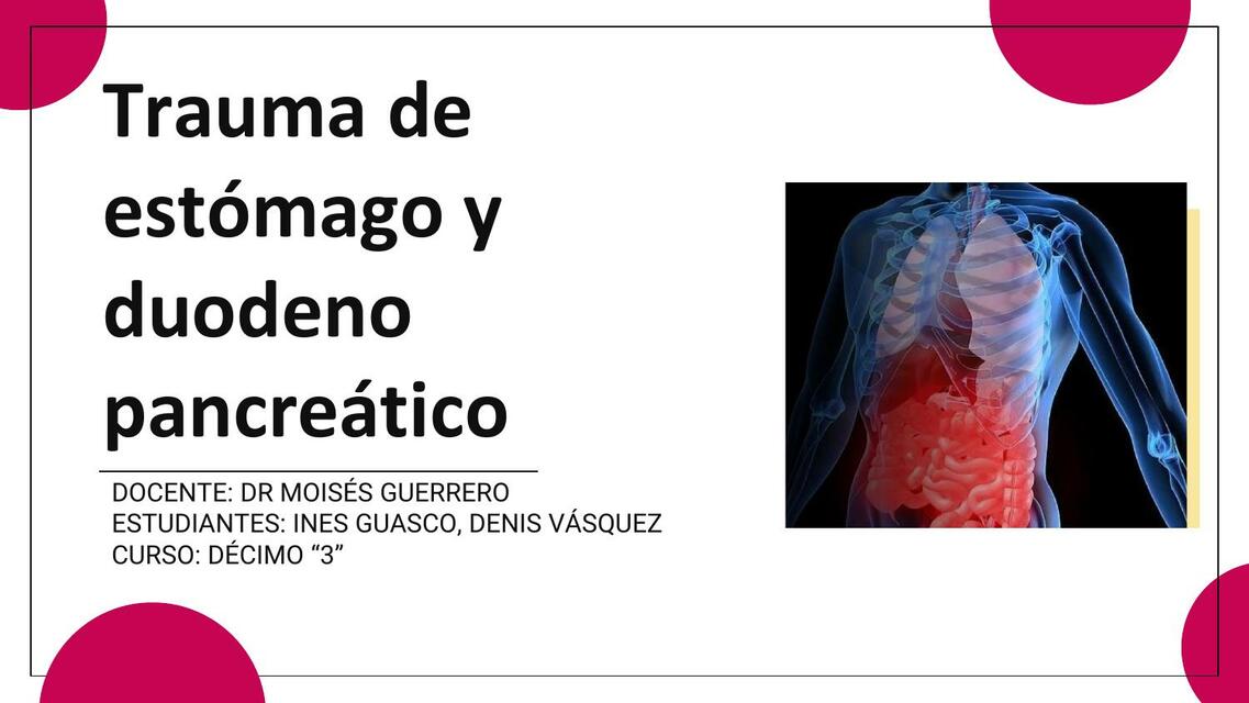 TRAUMA PANCREATICODUODEMAL Y GÁSTRICO