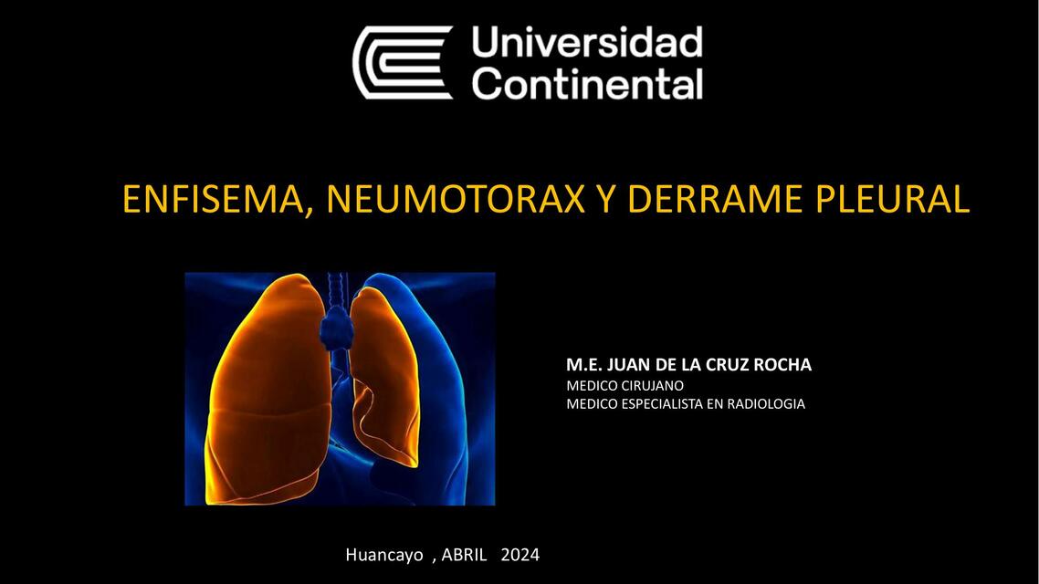 ENFISEMA NEUMOTORAX Y DERRAME PLEURAL