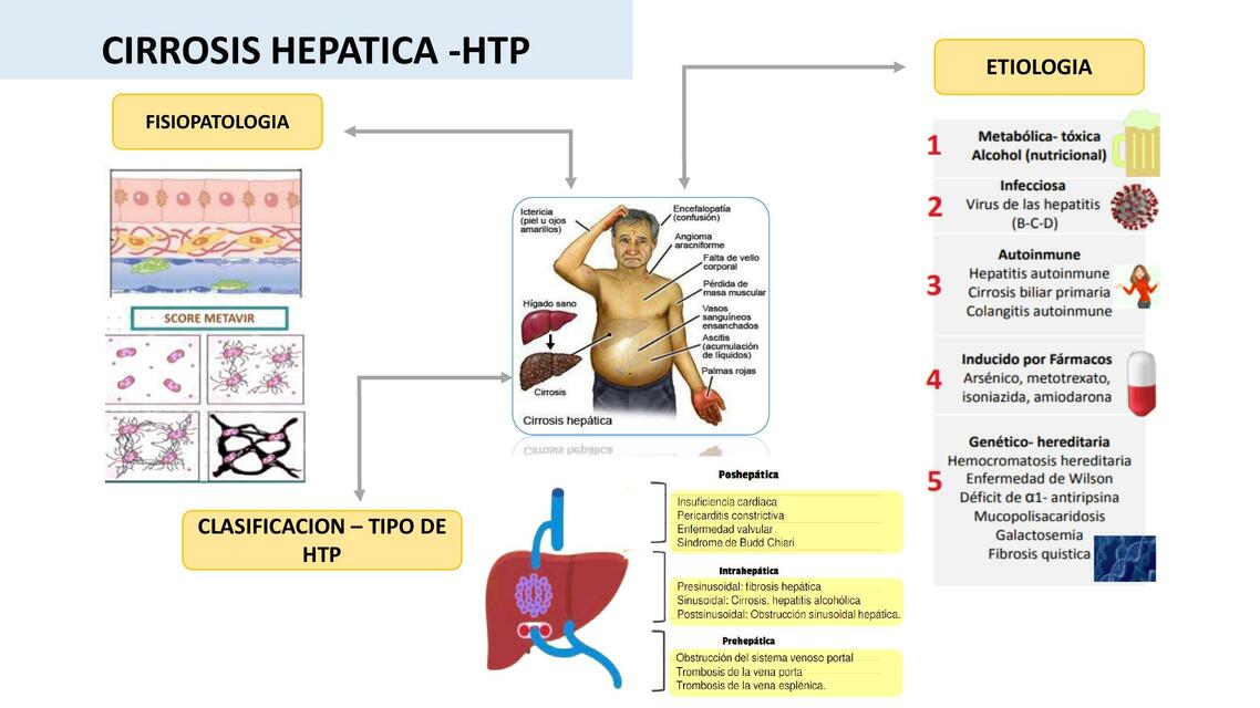 Cirrosis hepática 