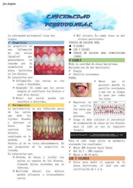 La enfermedad periodontal preventiva